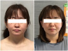 美容整体ウェリナ あま甚目寺院/小顔矯正/骨盤矯正/美脚サロン