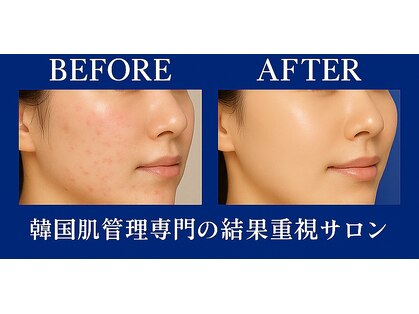 アンナビューティーサロン 博多店の写真