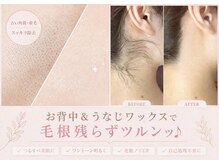 オアナヨーク(oana yoak)の雰囲気（根っこから抜くワックスならではの仕上がりでつるんつるんに♪）