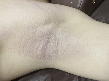 エステサロン桜/毛も匂いもおさらば！