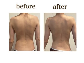 ルアバイアロ(Lua by Alo's)/肩こり改善&むくみケア