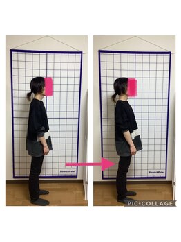 かなえ整体 武蔵新城駅前店/姿勢改善ビフォーアフター