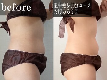 ルピエ(Lupir)/結果重視。効果を実感！