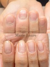マリーロール 天王寺店(Marie Laure)/自爪育成/深爪矯正/ネイルケア