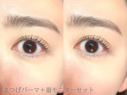 キト(KITO)の写真
