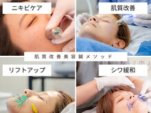ビランシア(BILANCIA)の雰囲気（お悩みに合わせた美容鍼コースを用意。）