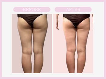 スリムライン 青森店(The Slim Line)/before→after