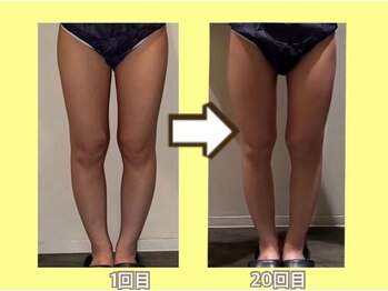 ビオール 新宿店(beall)/大人気!オーダーメイド痩身90分