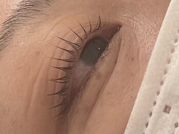 アップリップスダブリュー(Uplips.w)/