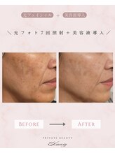 アマリー(Amary)/光フォト：Before→After