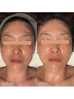 コモレビ(komorebi)/血色感UP・フェイスワックス♪