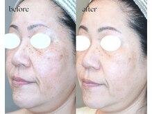 岩川治療院/５０代後半　女性のお客様