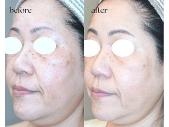 岩川治療院/50代後半 女性のお客様