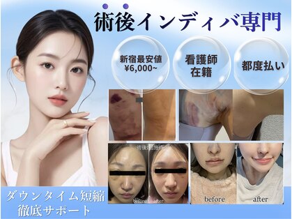 術後インディバ専門サロン 新宿の写真