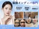 術後インディバ専門サロン 新宿の写真
