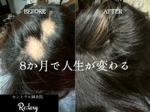セントラル鍼灸院リラクシー(Re:laxy)
