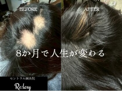 セントラル鍼灸院リラクシー(Re:laxy)の写真