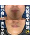 カナウ(KANAU)の写真/【メンズVIO脱毛が5,500円】全身脱毛やヒゲ脱毛が人気♪30代40代の男性が多くリピートして卒業しています！
