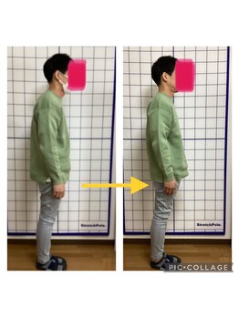 かなえ整体 武蔵新城駅前店/姿勢改善ビフォーアフター