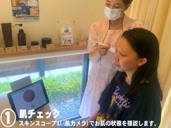ビューネット(BEAUNet)/1.肌チェック
