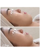 レ ベージュ(L’Beige)/リアボーテ肌質改善フェイシャル