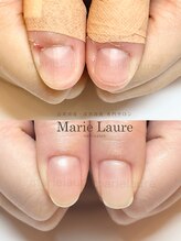 マリーロール 淀屋橋本店(Marie Laure)/自爪育成/深爪矯正/ネイルケア