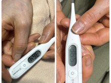 レモングラス/施術後［体温が0．1アップ。