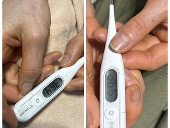 レモングラス/施術後［体温が0．1アップ。