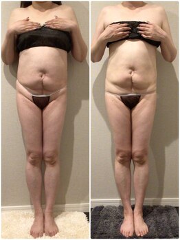 ジャスミン スパ(Jasmine spa)/お腹のお肉が気になる…。