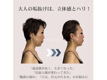 アンジェリカ(Angelica)の雰囲気（脱！疲れ顔＆老け顔/たるみ改善×垢抜け★間延び顔改善サロン）