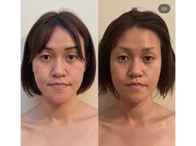 グレースフィオーレ モラージュ柏店(gracefiore)/【ヘッドスパ】ビフォーアフター