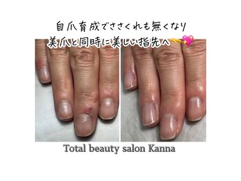 カンナ(Kanna)/5500円