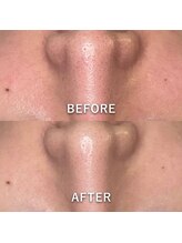 マーブルスタイル(MARBLE STYLE)/【BeforeAfter】 1回目/3回目