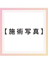 ブレア 元町/施術写真