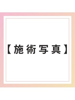 ブレア 元町/施術写真