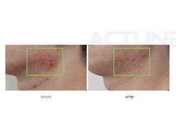 サロンドオフ 御堂筋店(salon de off)/