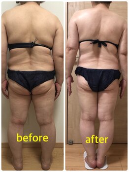 サロンドルフレ(salon de Reflet)/360度美ボディ☆