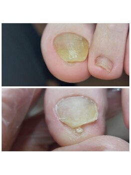 爪切り屋 足楽/こんなところに？