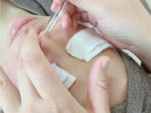 アリィ エステティック(allie esthetic)/オプション【毛穴ケア】