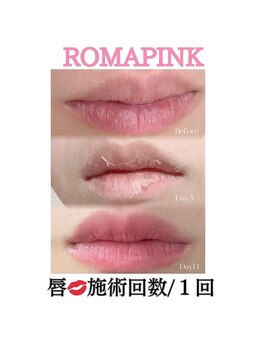 サラ/ローマピンク