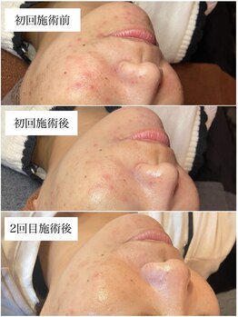 ブラックボックス(BLACK BOX)/30代女性のお客様