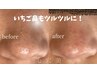 【全顔角栓除去】いちご鼻・黒ずみ一掃でゆで卵肌へ ￥13,000→初回￥10,000