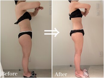 カレンジェビューティー(CarengeBeauty)/全身コース