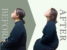 河(KOU)/ビフォーアフター3