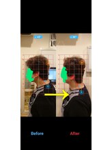 ふくろう整骨院/ビフォーアフター