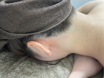 ミース 越谷店/うなじ矯正●Before、After