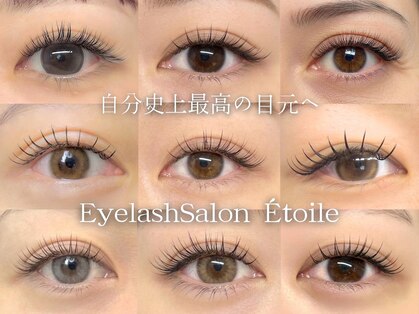 エトワール(Etoile)の写真