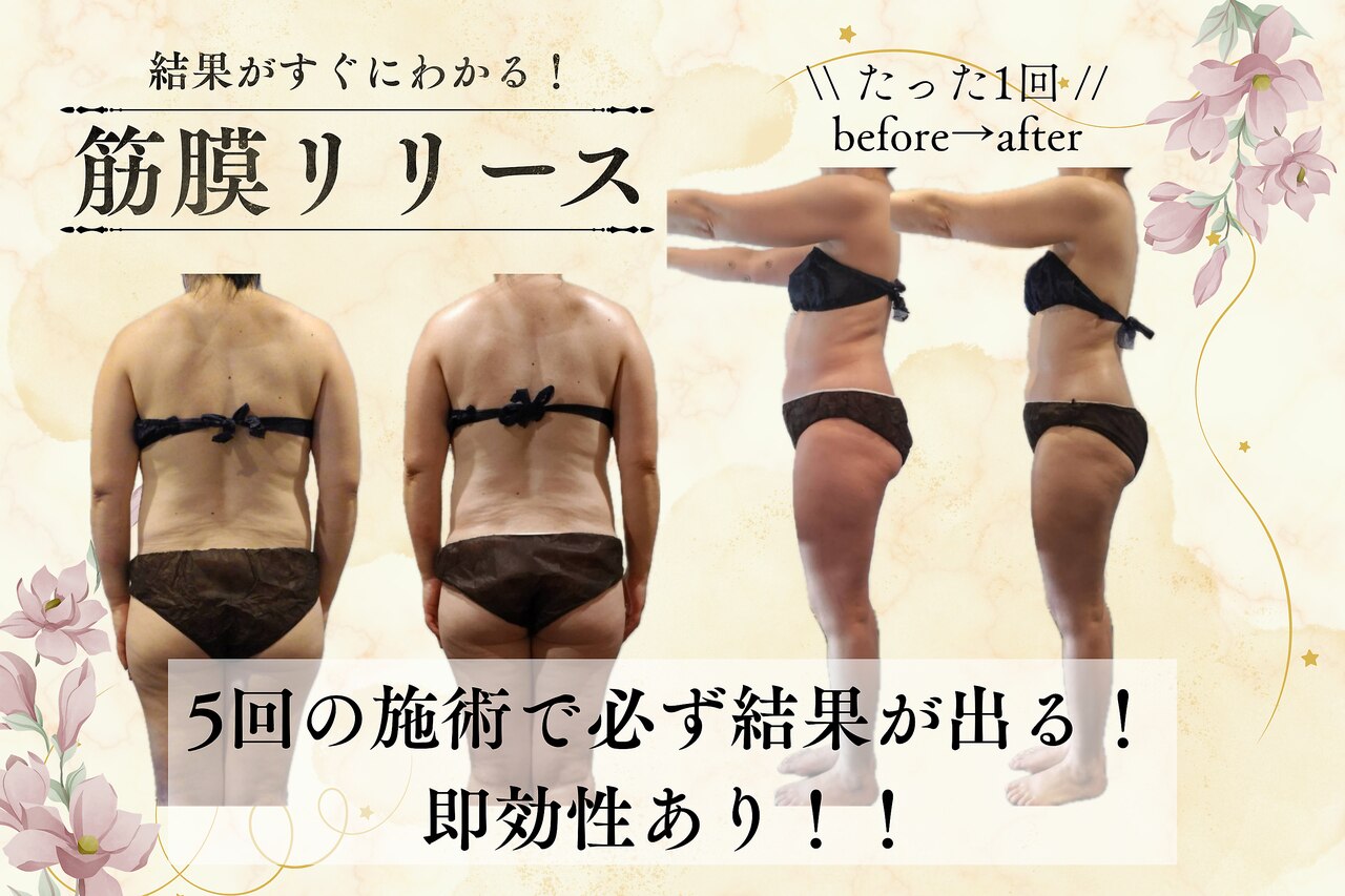 佐久市でEMSが人気のエステサロン｜ホットペッパービューティー
