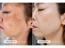 アンジュ(Anju)の雰囲気（クリニックレベルの効果を発揮する高品質な製剤と技術力をご提供）