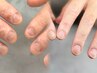 《hand》深爪・爪噛み 改善《自爪育成3回コース》(1回辺り/¥6,000×3回分)